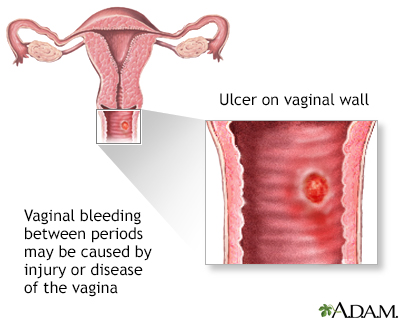 Hot Susie Wilden Bleeding When Your Pregnant